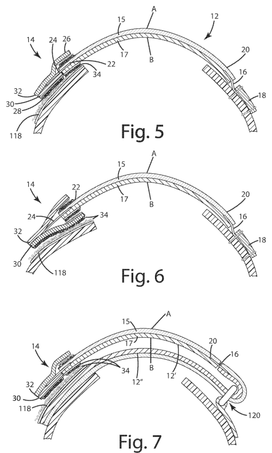 Sheet 1 of the patent drawings