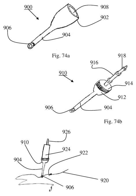 Sheet 1 of the patent drawings